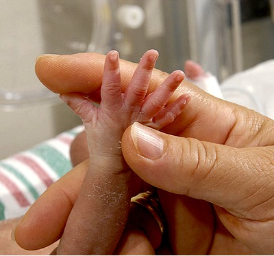 Premature-Babys-Hand-in-Fathers-Hand