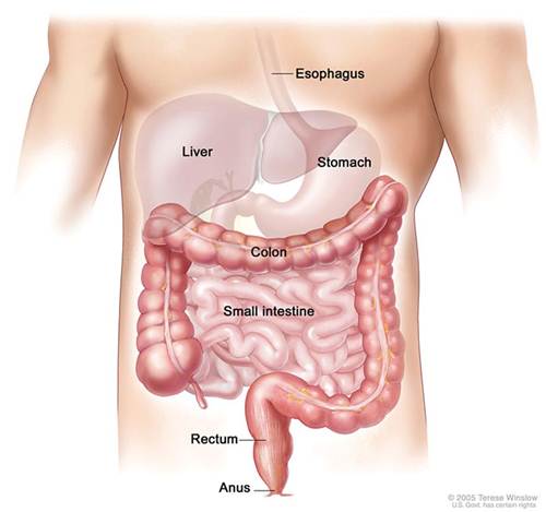 colon-cancer