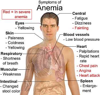 Anaemia