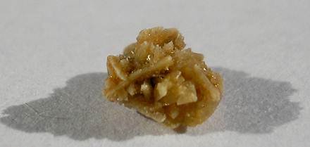 kidney stone