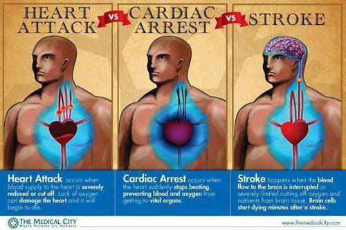 heart-attack-cardiac-arrest-stroke