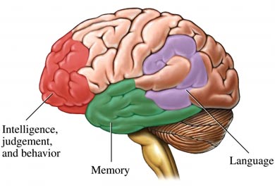 Dementia