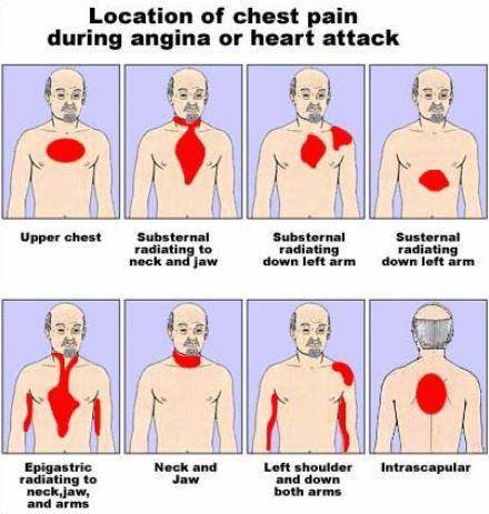 chest-pain